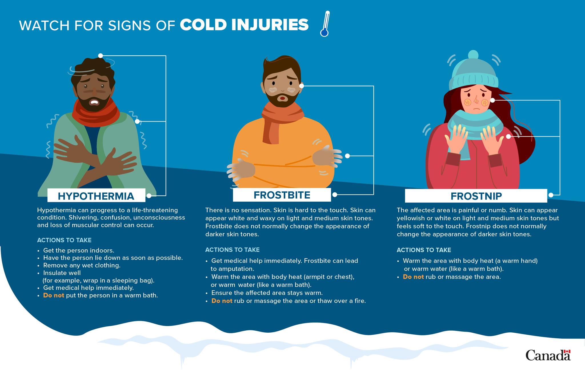 watch for cold injuries